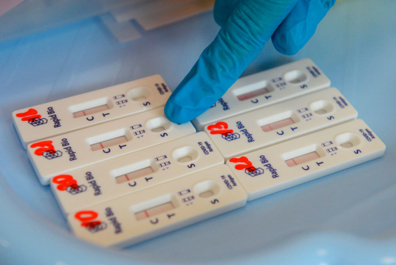 В РФ начинаются испытания кожного теста на иммунитет к ковиду